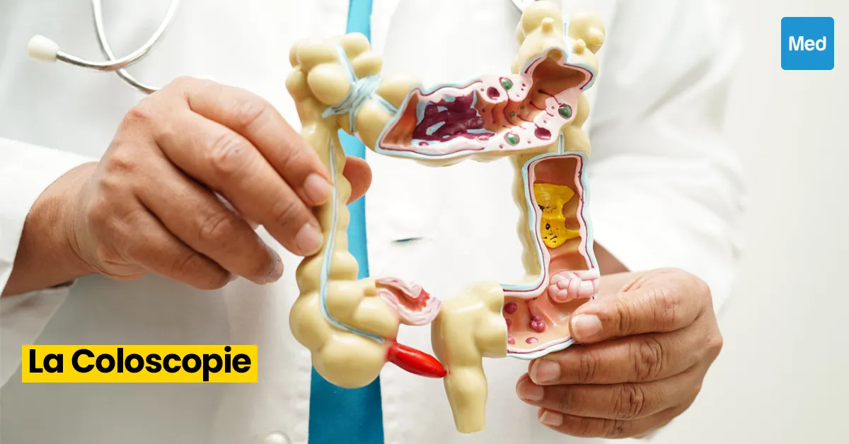 La Coloscopie : Un Outil Puissant dans la Prévention du Cancer Colorectal